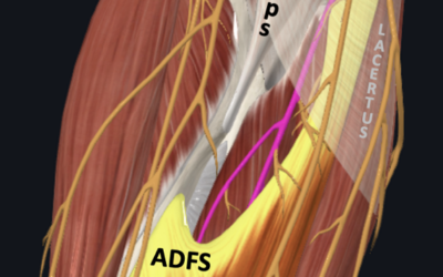 Opération pour un syndrome de l’ADF